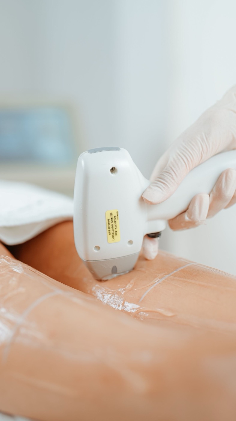 Laser-Handstück während der Behandlung